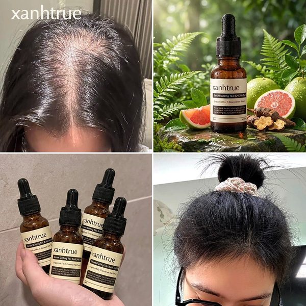 Combo 4 lọ - Feedback sau hơn 2 tháng