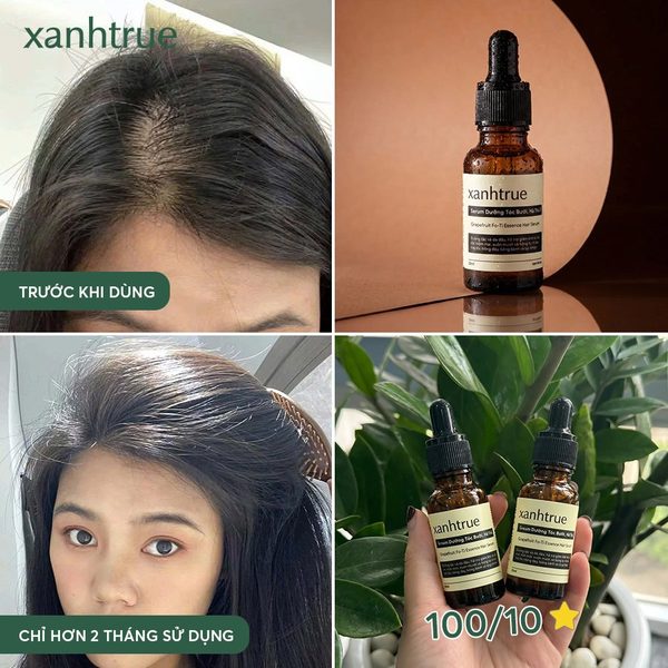 Trước - sau 4 tuần dùng serum