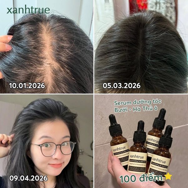 Tiến trình 4 mốc thời gian