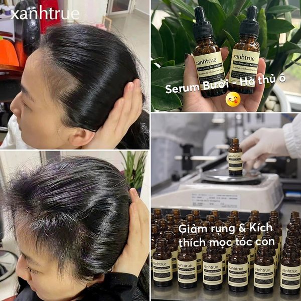 Feedback 2 tuần tóc mọc thấy rõ